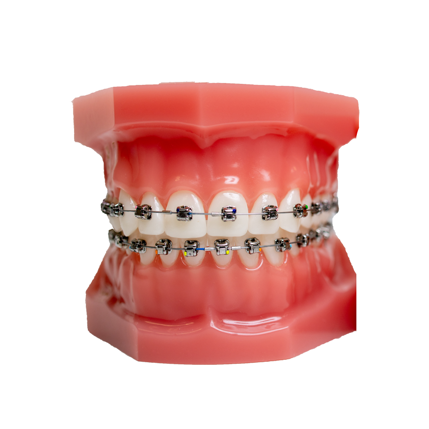 Ortho restoration