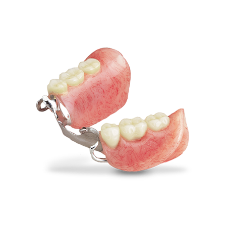 Partial Denture